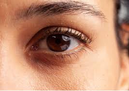 Dark Circles
